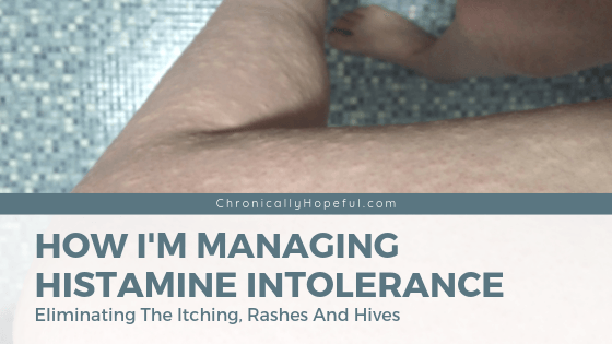 Char's bare leg full of itchy bumps. Title reads: How I'm managing histamine intolerance. Eliminating the itching, rashes and hives.